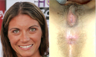 Misty May-Treanor